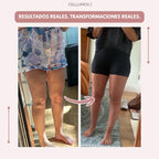 Cellumove 3D Legging – Despídete del dolor y la fatiga del lipedema de forma natural