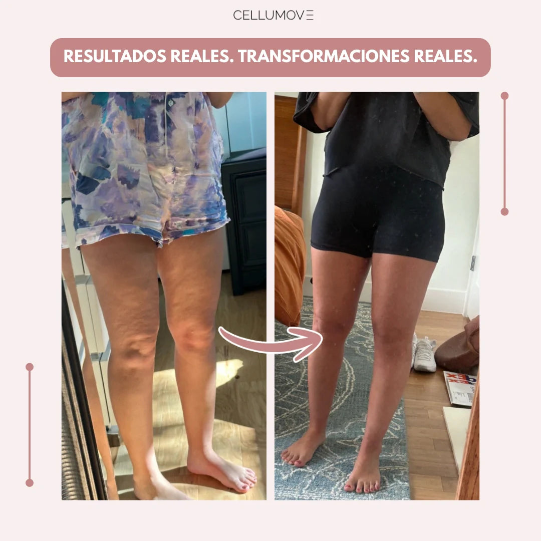 Cellumove 3D Legging – Despídete del dolor y la fatiga del lipedema de forma natural