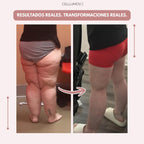 Cellumove 3D Legging – Despídete del dolor y la fatiga del lipedema de forma natural