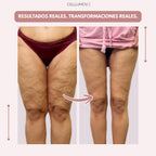 Cellumove 3D Legging – Despídete del dolor y la fatiga del lipedema de forma natural