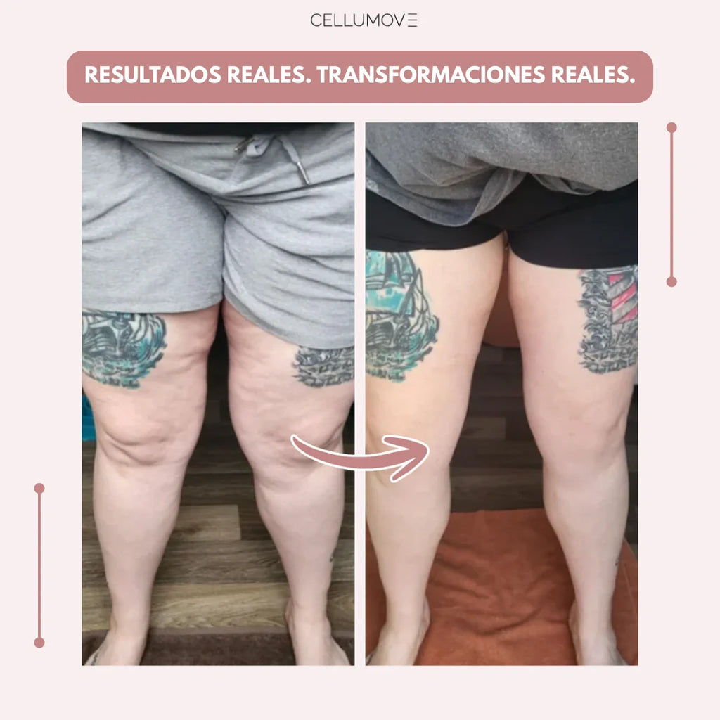 Cellumove 3D Legging – Despídete del dolor y la fatiga del lipedema de forma natural